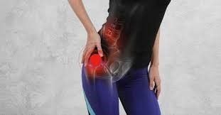 Trochanteric/Hip Bursitis Trochanteric/Hip Bursitis